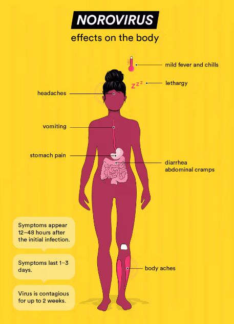 Norovirus Symptoms
